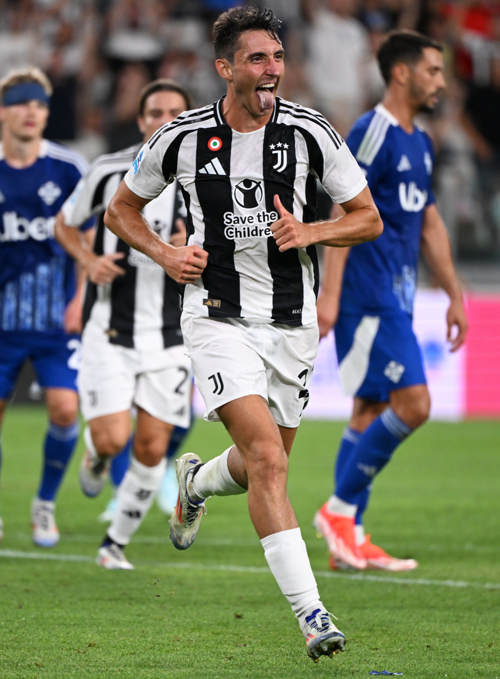 手碰撞受伤 手碰撞受伤